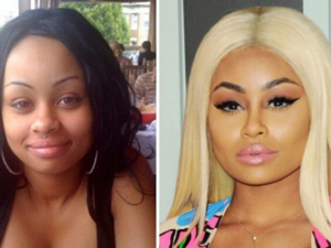 List : 5 Latest Celebrities Who Bleached Their Skin [with Photos]