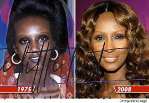 List : 5 Latest Celebrities Who Bleached Their Skin [with Photos]