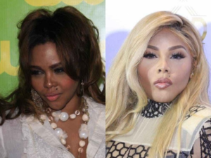 5 Latest Celebrities Who Bleached Their Skin [with Photos]