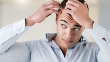Male Haircuts to Disguise Baldness