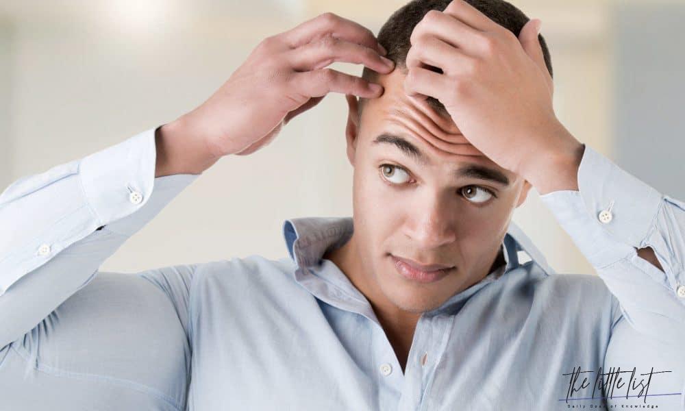 Male Haircuts to Disguise Baldness