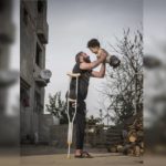 Photo of father and son injured in the Syrian War wins award
